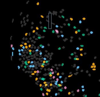 Schematic representation of activated neurons in the olfactory cortex during a live experiment using a miniature microscope, when mice eat slowly. The mice were offered nutritionally identical food with different flavors (strawberry and chocolate) as well as a sugar solution. We observed a clearly separated representation of neurons responding to strawberry flavor (blue), chocolate flavor (orange), and the sugar solution (green). During fast eating (“binge feeding”), these neurons are suppressed. © Neuron | Johenning